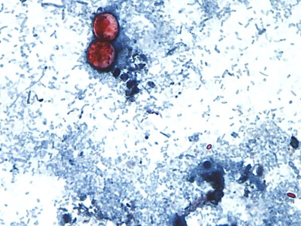Two red oval cells on a blue-stained microscope field with scattered blue debris.